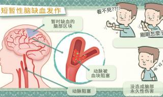 脑供血不足什么症状